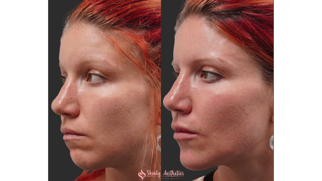 Before and after treatment.
