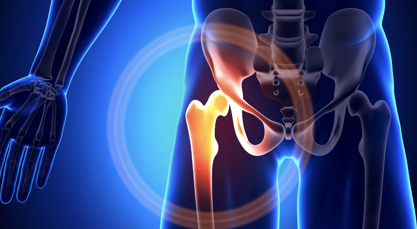 A digital medical illustration of the human body focusing on the hip joint. The hip and thigh bones are highlighted, with the hip joint area glowing in red and yellow, indicating pain or inflammation, set against a blue background. A partial view of the arm is seen.