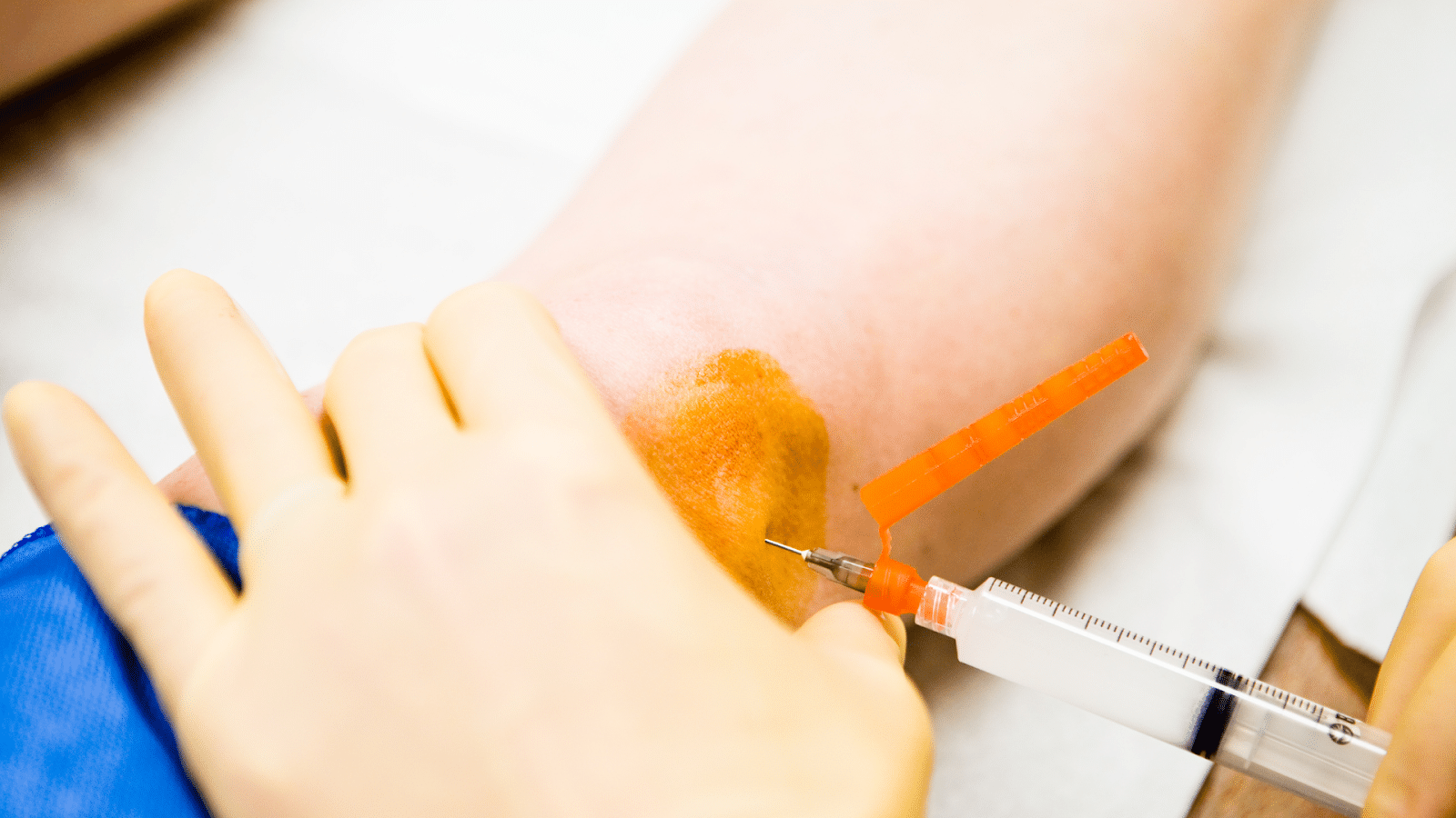 A close-up of a person's arm being prepared for an injection. The area is being cleaned with an antiseptic, and a healthcare worker wearing gloves is holding a syringe, ready to administer the injection.