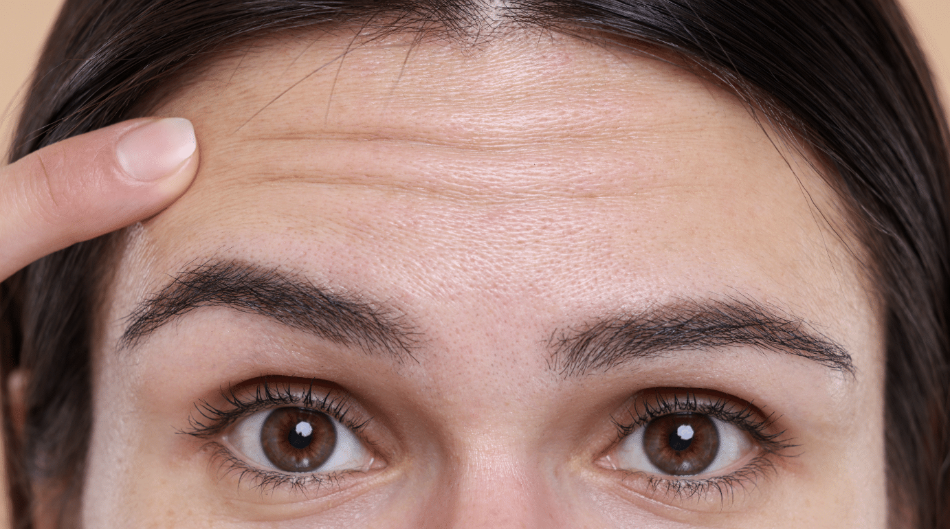 A close-up of a person's face highlighting the forehead and eyes. The person is pointing to a wrinkle on their forehead with their index finger. The skin texture and detail of the eyes, eyebrows, and wrinkles are clearly visible.