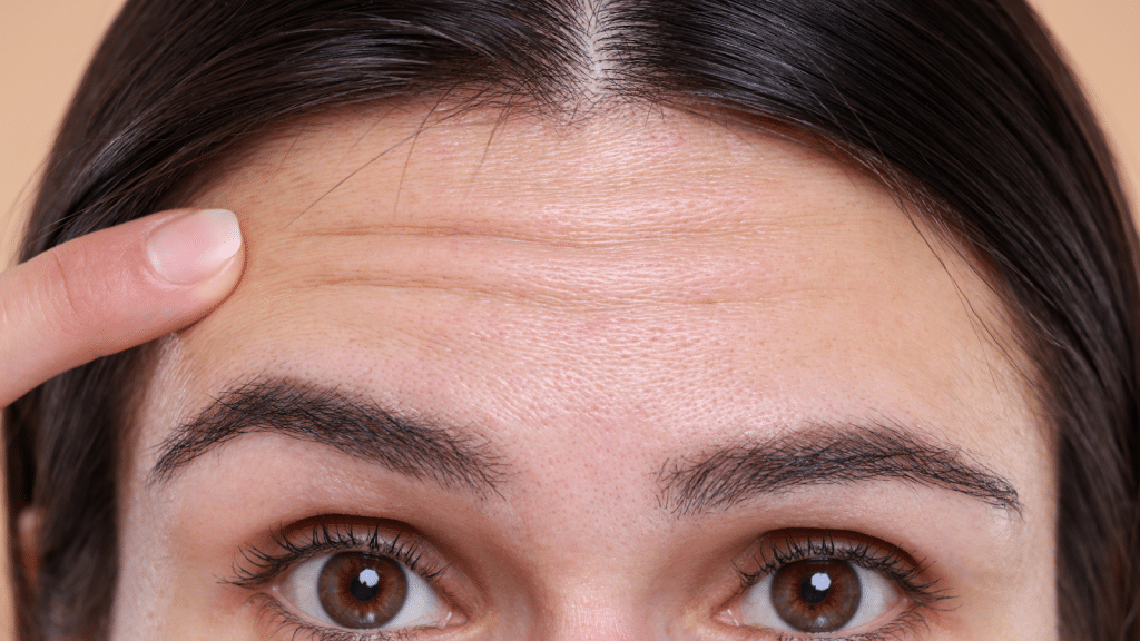 Close-up of a person with dark hair pointing to fine lines on their forehead. The image highlights the texture and appearance of the skin, with a focus on natural expression lines and skin detail.