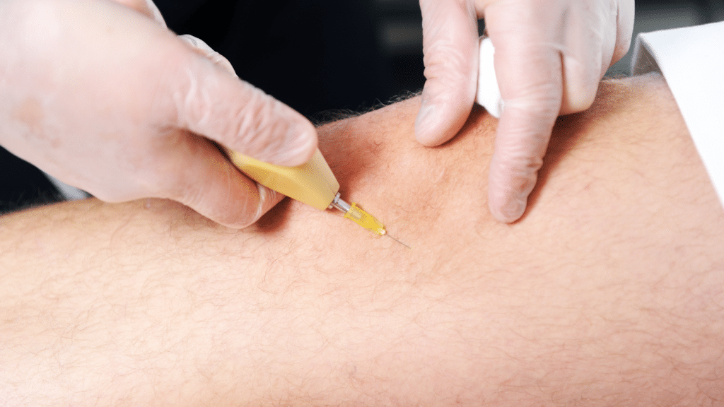 A person wearing gloves is inserting a needle into someone's arm. The needle is attached to a yellow holder and is being used for a medical procedure, such as drawing blood or administering an injection. The arm is in close focus.