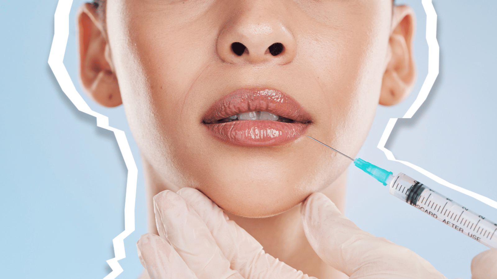 A person receiving a cosmetic injection in the lips. A gloved hand holds their chin, and a syringe is aimed at their lip area. The background is blue with a white outline around the figure.