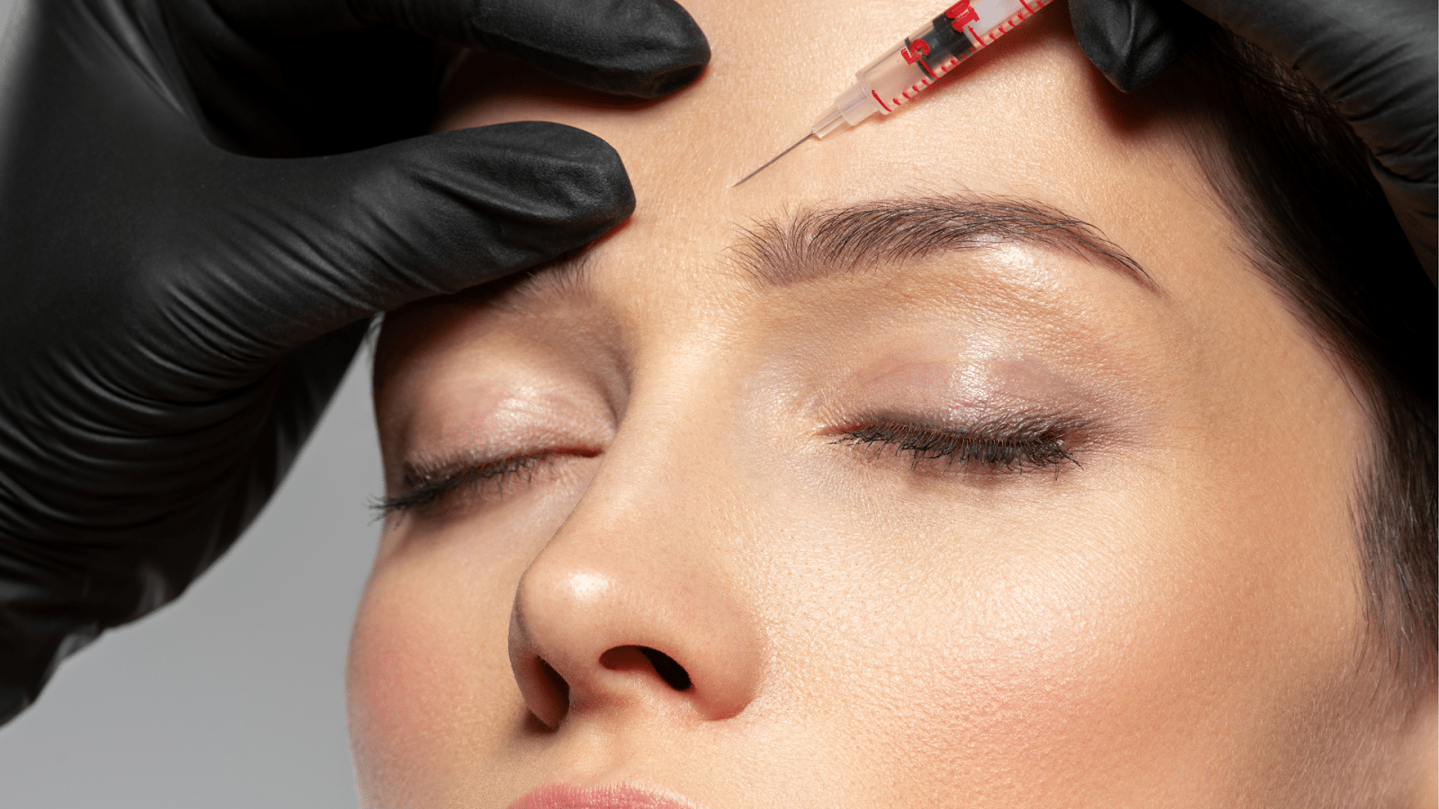 A close-up of a person's face with closed eyes, receiving an injection in the forehead. The injector is wearing black gloves and is using a syringe with a red liquid. The skin appears smooth and the background is neutral.