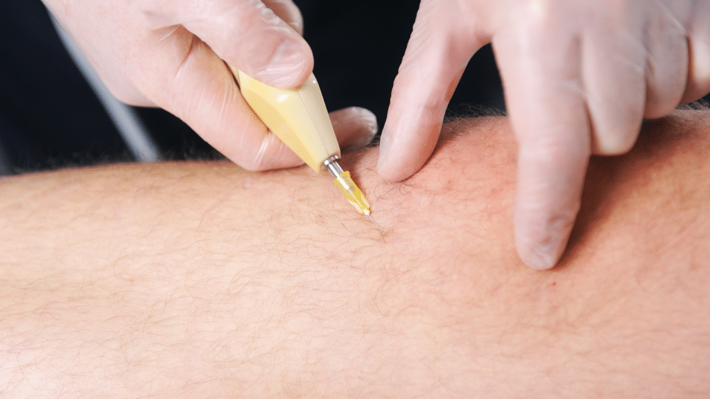 Close-up of a person receiving a treatment with a small yellow device on their skin. The person administering the treatment is wearing gloves. The focus is on the interaction between the device and the skin.