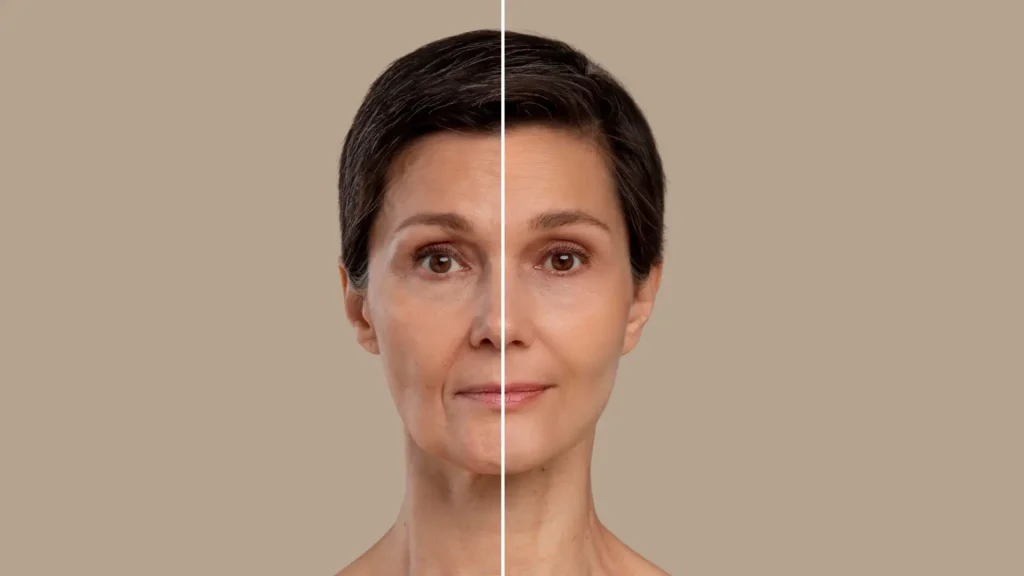 woman's face in half showing before and after