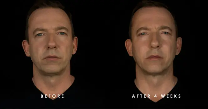 man got better facial volume