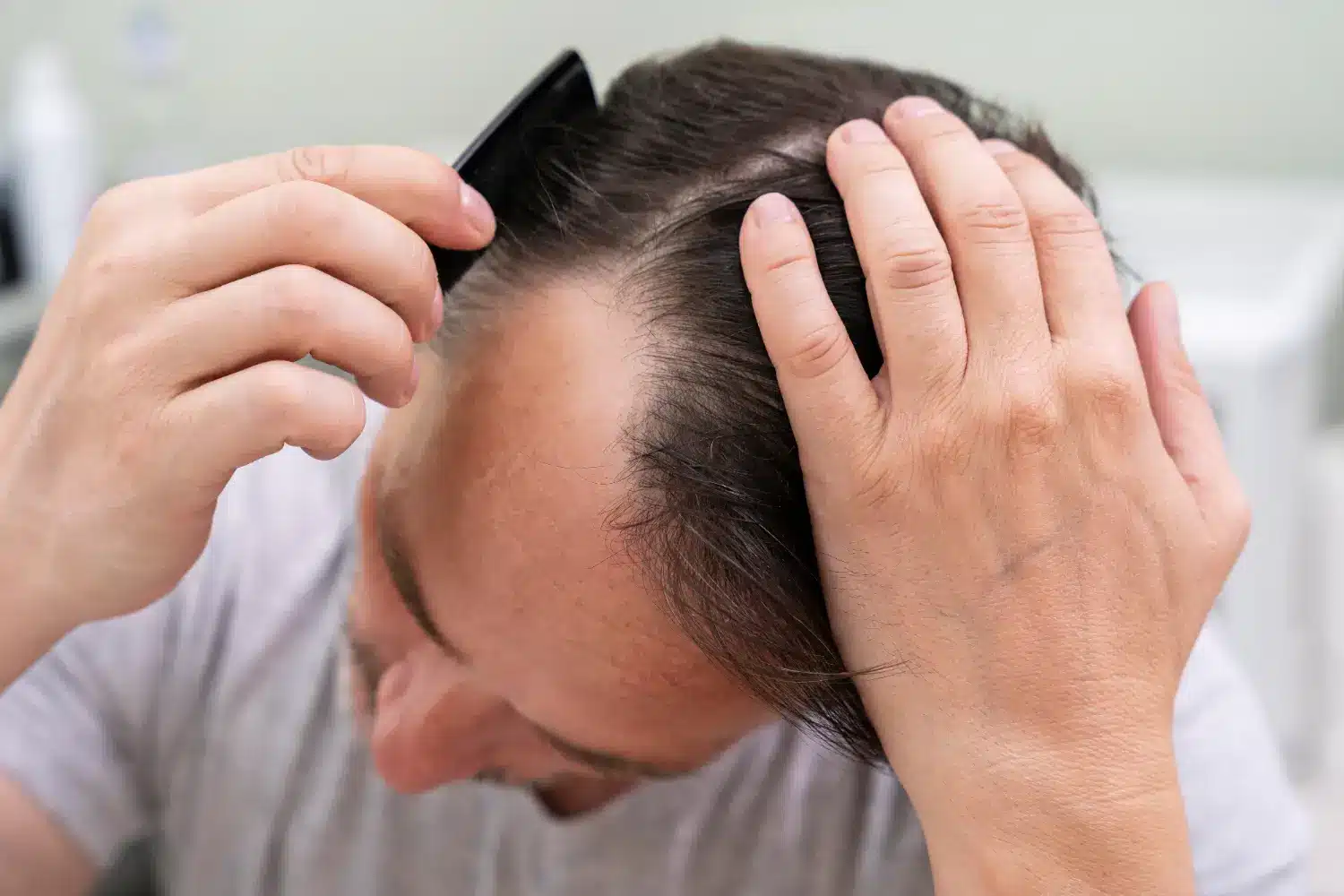 showing his scalp