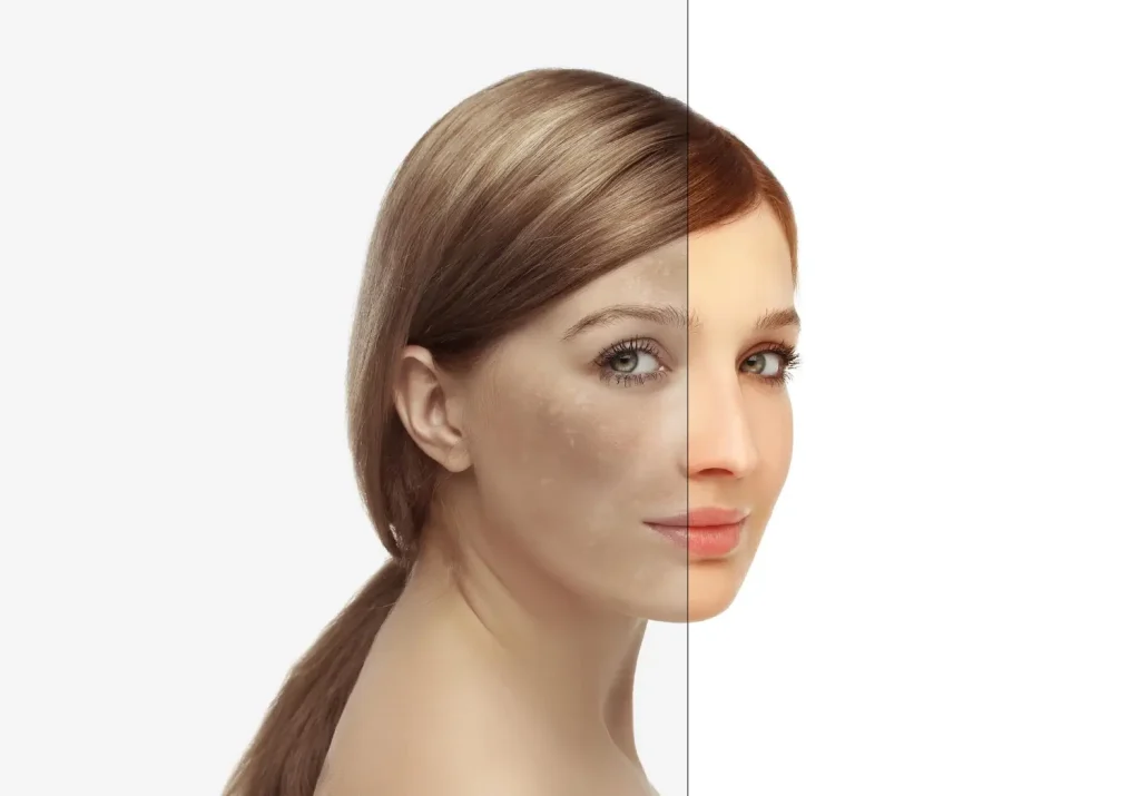 patient showing her face before and after the injection