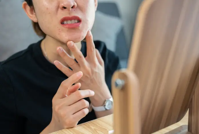 woman having redness in her face