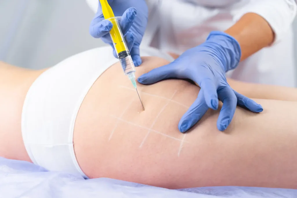 doctor helps enhance the patient's butt with an injectable treatment