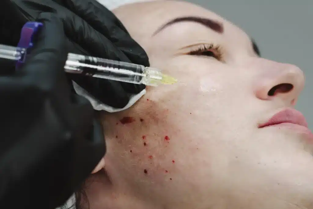 Blood on the patient's face during injection